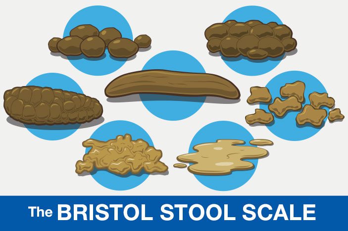 Common Poop Shapes Guide